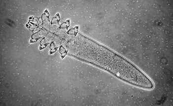 Demodex (dok. National Rosacea Society)