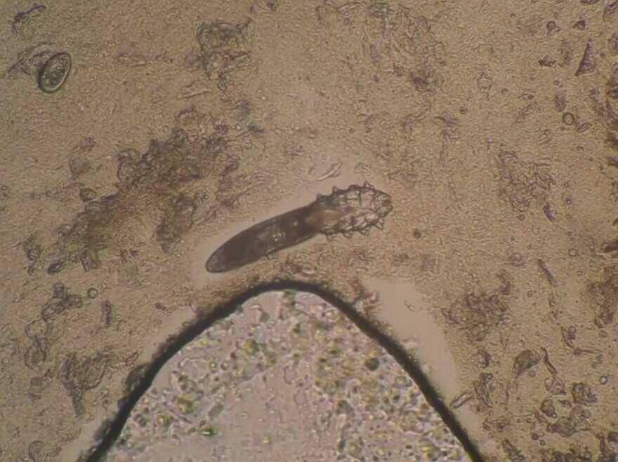 Demodex di dalam komedo manusia. (youtube.com/LiC Experiment)