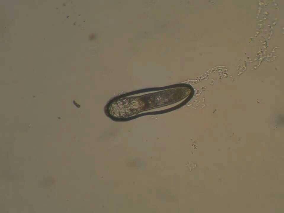 Demodex teramati di mikroskop. (youtube.com/LiC Experiment)