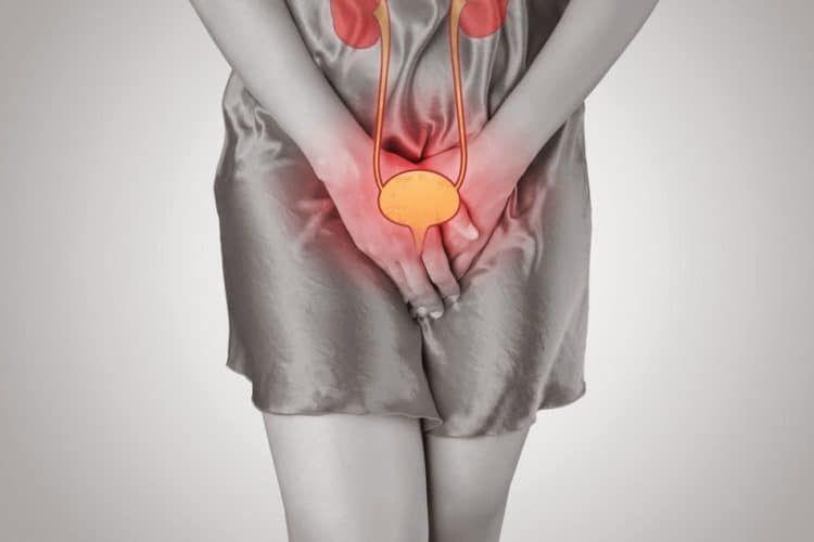 Cystitis: Penyebab, Gejala, Pengobatan, Komplikasi, Pencegahan