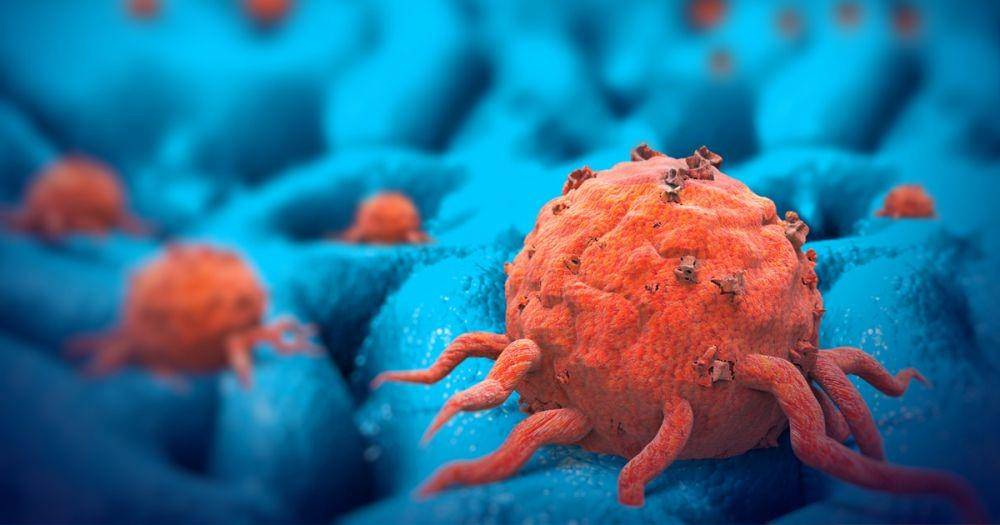 ilustrasi sel kanker (cancercenter.com)
