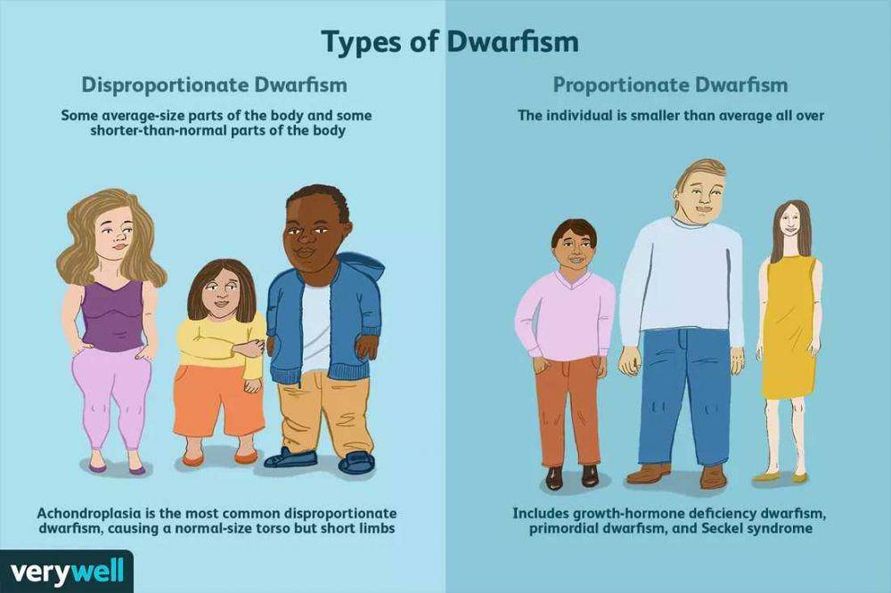 ilustrasi tipe dwarfisme (verywellhealth.com/Jessica Olah)
