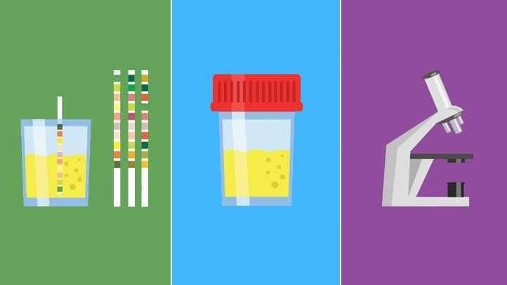 ilustrasi pemeriksaan urine (everydayhealth.com)