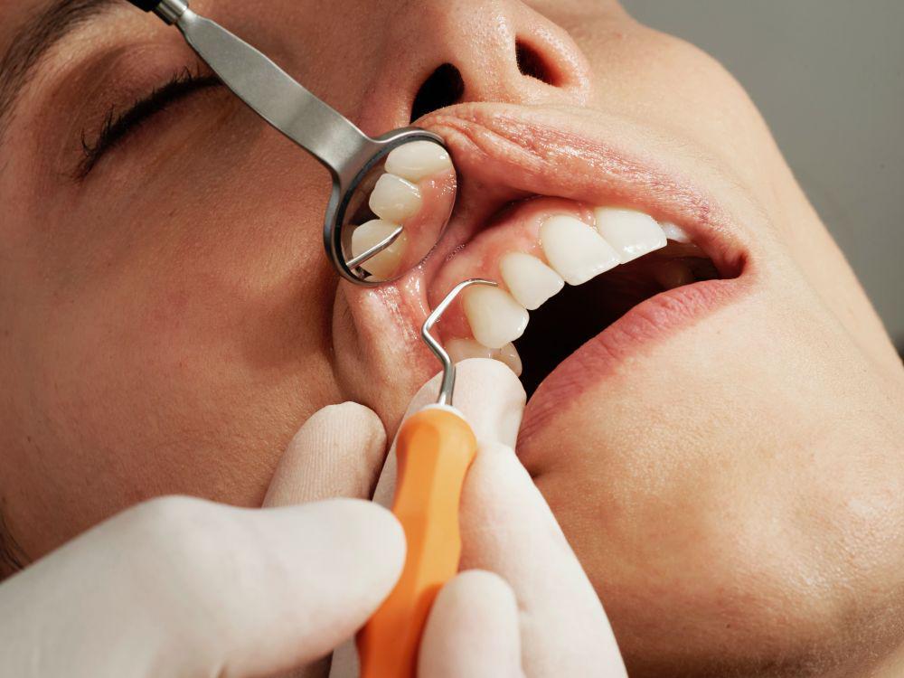 Gigi Goyang, Apakah Jaringan Periodontal Terganggu?