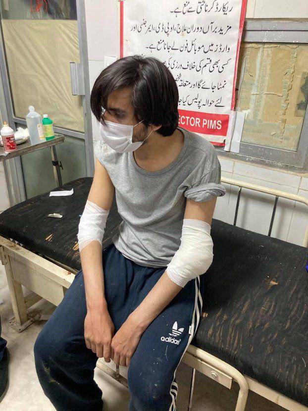 Jurnalis Pakistan Asad Ali Toor yang berada di rumah sakit setelah diserang pada 25 Mei 2021. (Twitter.com/Noreen Haider)