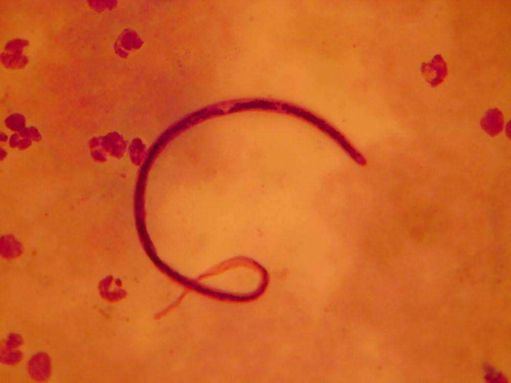 ilustrasi parasit Brugia malayi penyebab filariasis limfatik (flickr.com/Michael Wunderli)