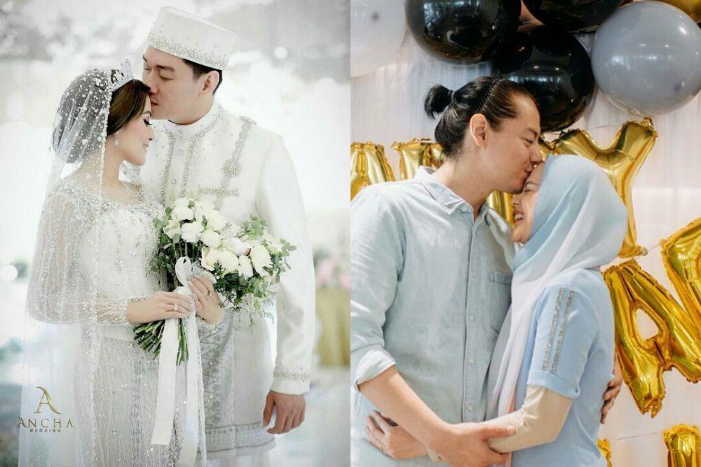 9 Pasangan Artis yang Pamer Foto Ciuman di Kening, Secinta Itu!