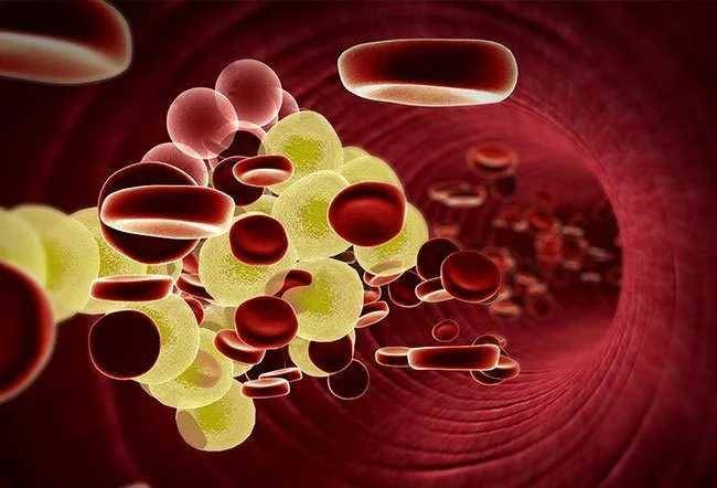 ilustrasi kolesterol dalam darah (medicinenet.com)