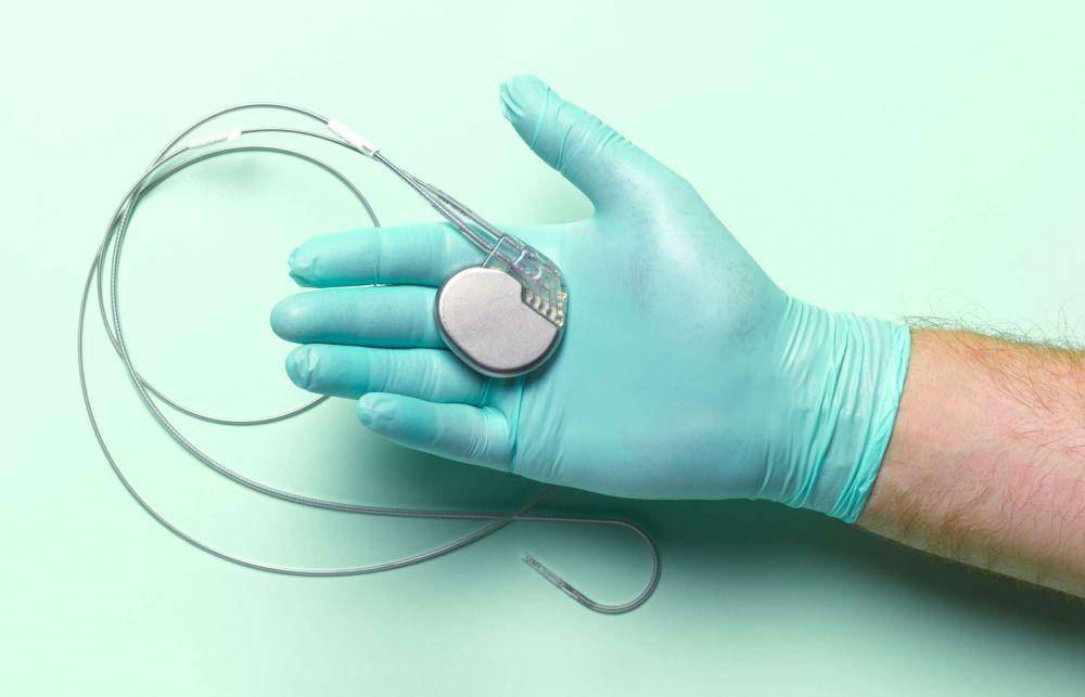 ICD dan prosedur pemasangannya (verywellhealth.com)