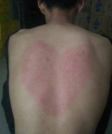 kerokan saat masuk angin kocak (1cak.com/Hanif_ntok)