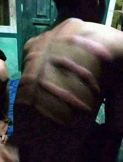 kerokan saat masuk angin kocak (1cak.com/deniwh)