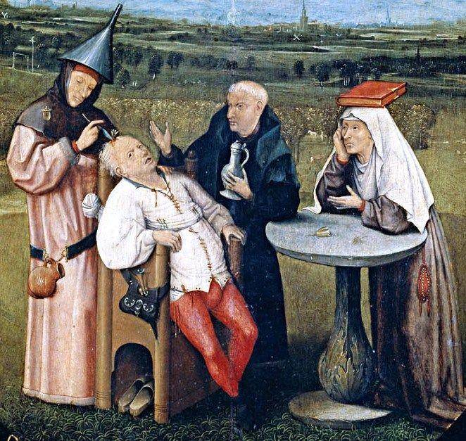 ilustrasi trepanasi (wikimedia.org)