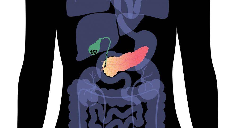 Batu empedu dapat menyebabkan pankreatitis akut (gastroenterologyadvisor.com)