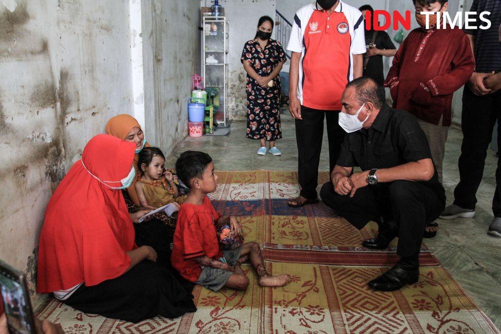 Jenguk Bocah yang Kena Penyakit Aneh, Gubernur Edy Bikin Tim Khusus