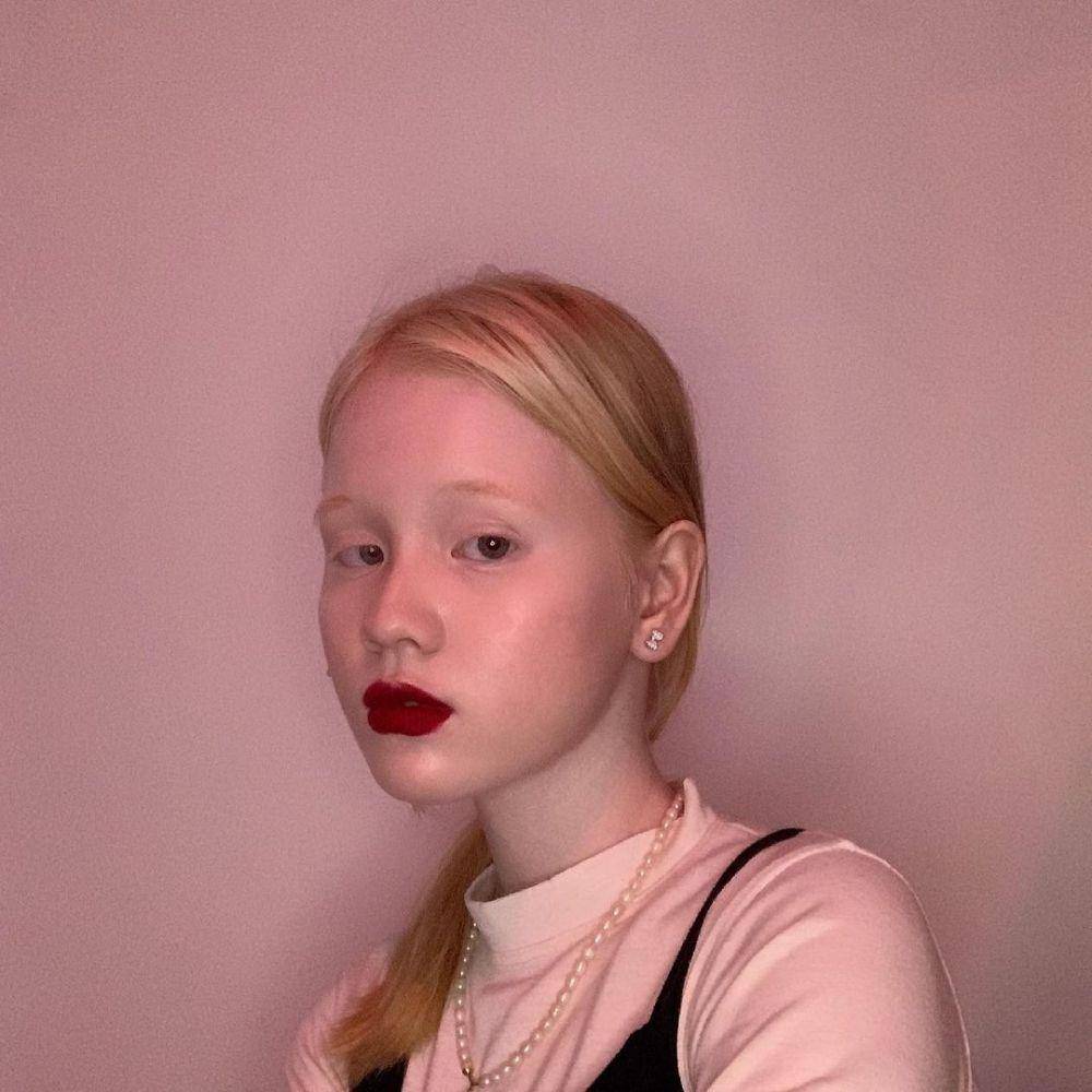 Anindhita Asmarani, seleb TikTok albino (instagram.com/asmaraninn)