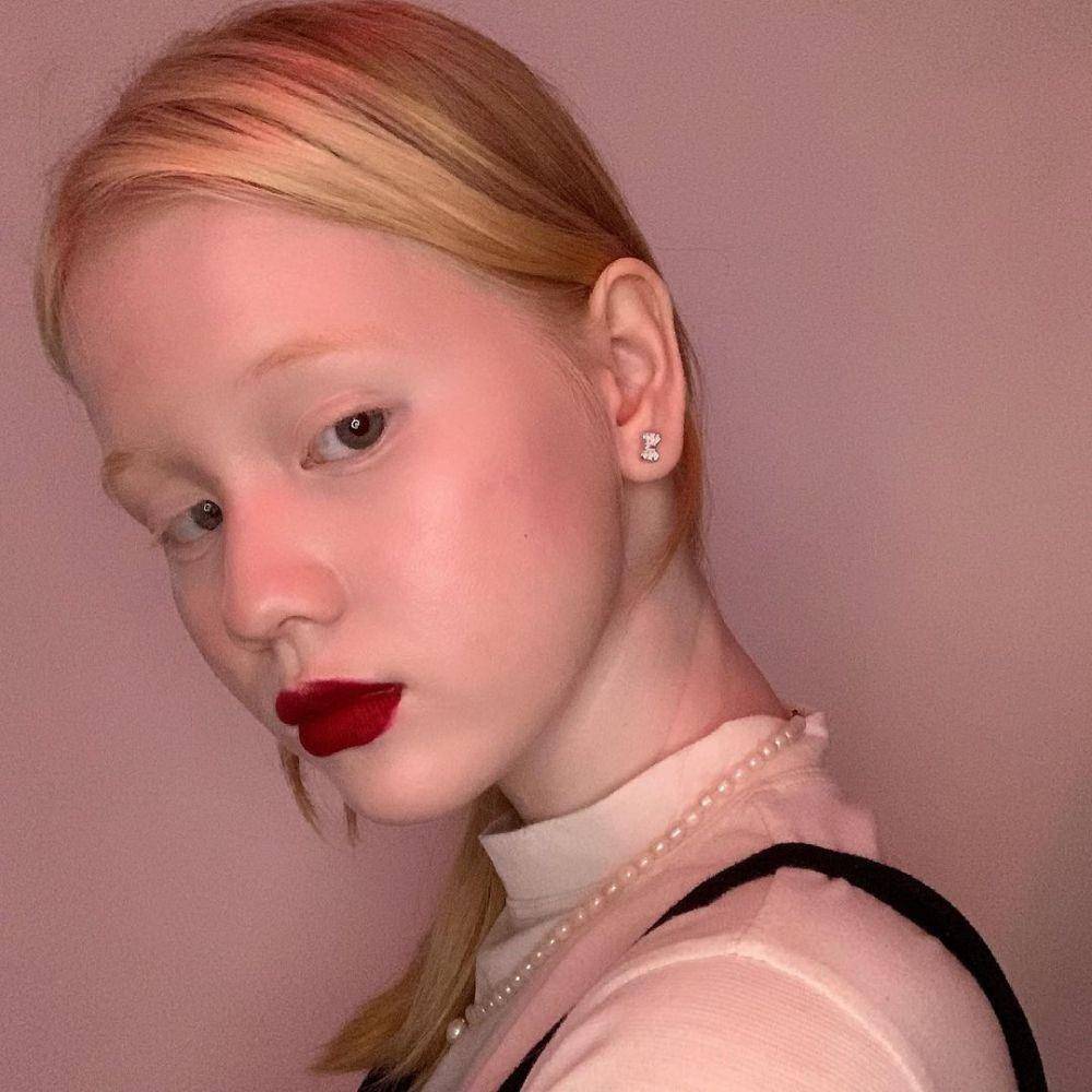 Anindhita Asmarani, seleb TikTok albino (instagram.com/asmaraninn)