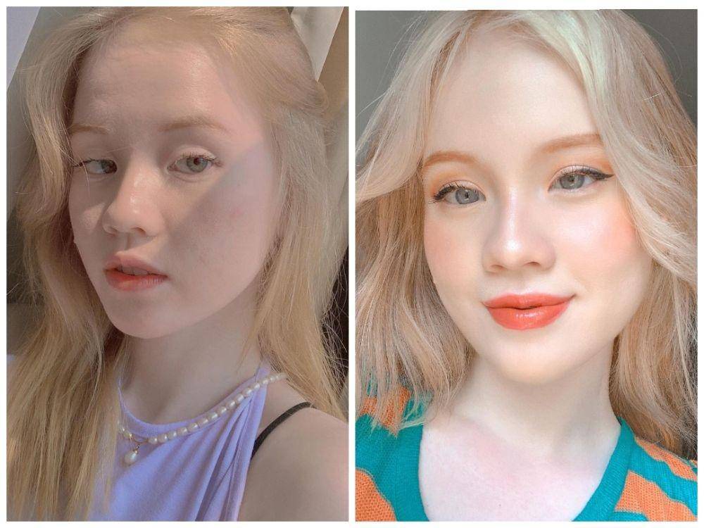 Anindhita Asmarani, seleb TikTok albino (instagram.com/asmaraninn)
