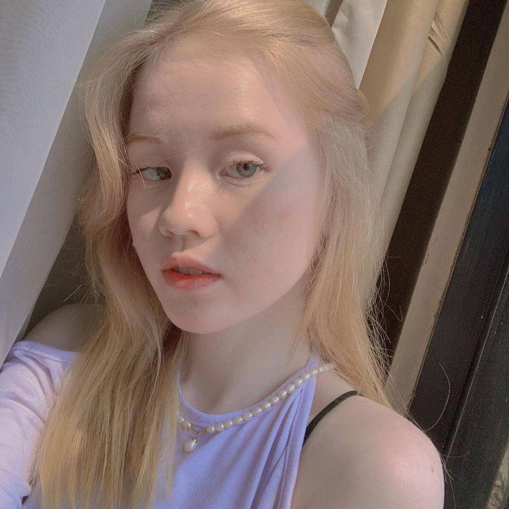 Anindhita Asmarani, seleb TikTok albino (instagram.com/asmaraninn)