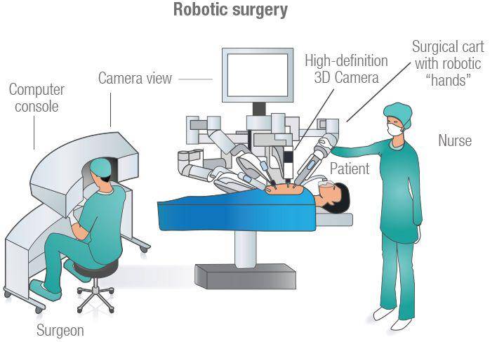 ilustrasi robotic surgery (materprivate.ie)