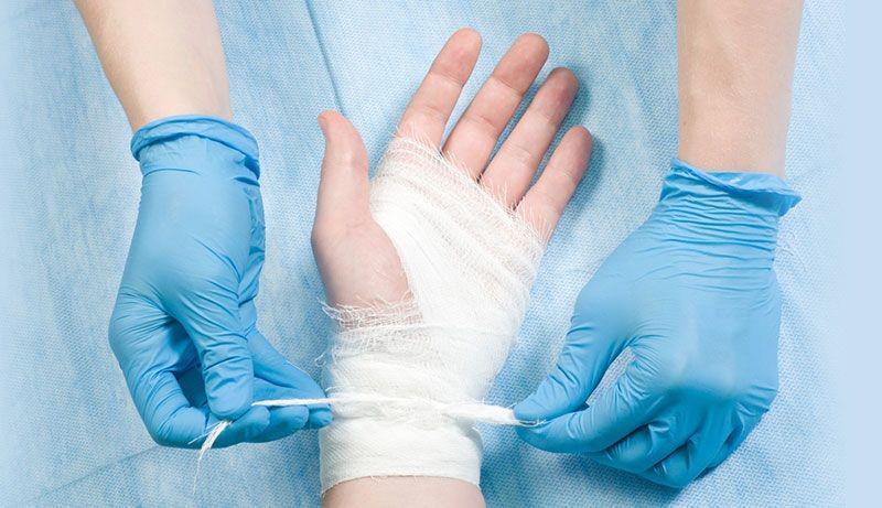 5 Alasan Mengapa Kamu Tetap Perlu Merawat Lukamu walaupun Kecil