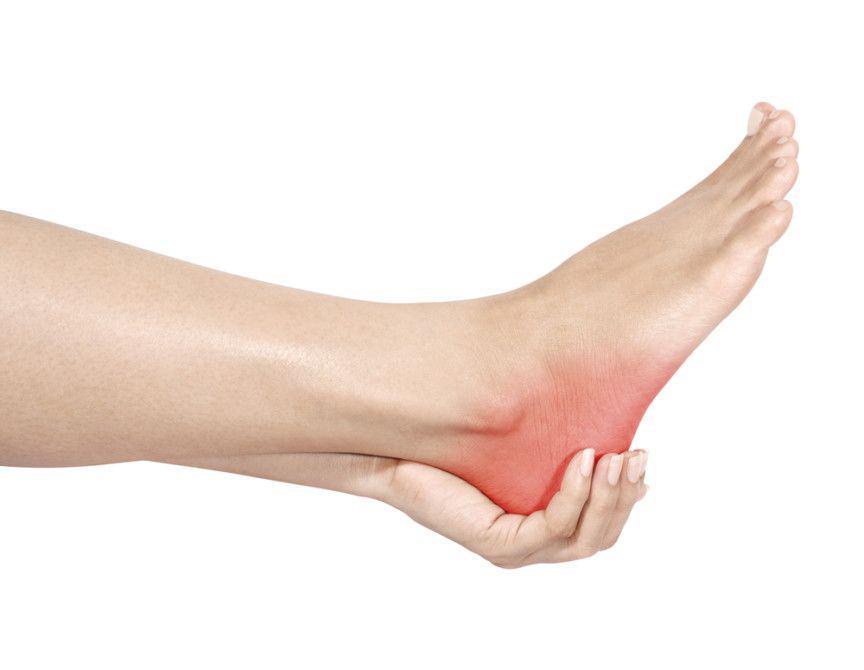 Mengenal Plantar Fasciitis, Salah Satu Penyebab Umum Nyeri Tumit