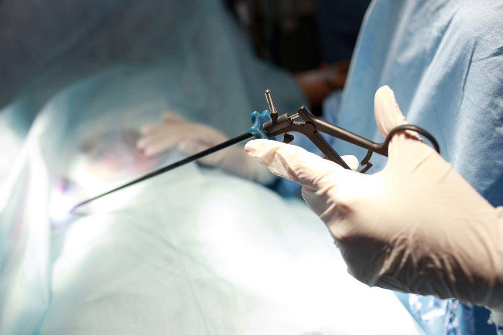 ilustrasi laparoskopi (astralaparoscopy.com)