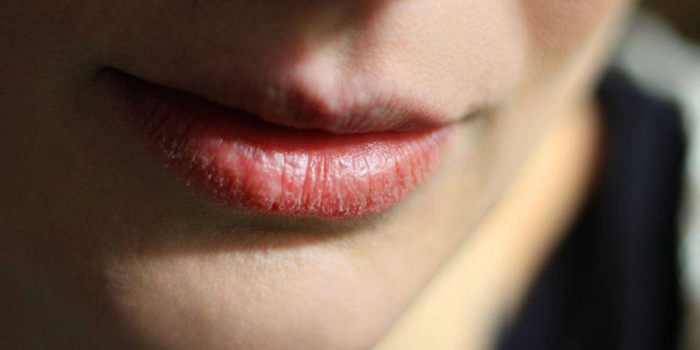 ilustrasi bibir kering (womenshealthmag.com)