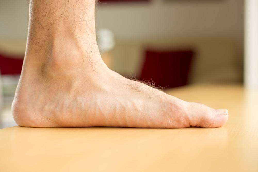 ilustrasi kaki datar (urgentlyorthoaz.com)