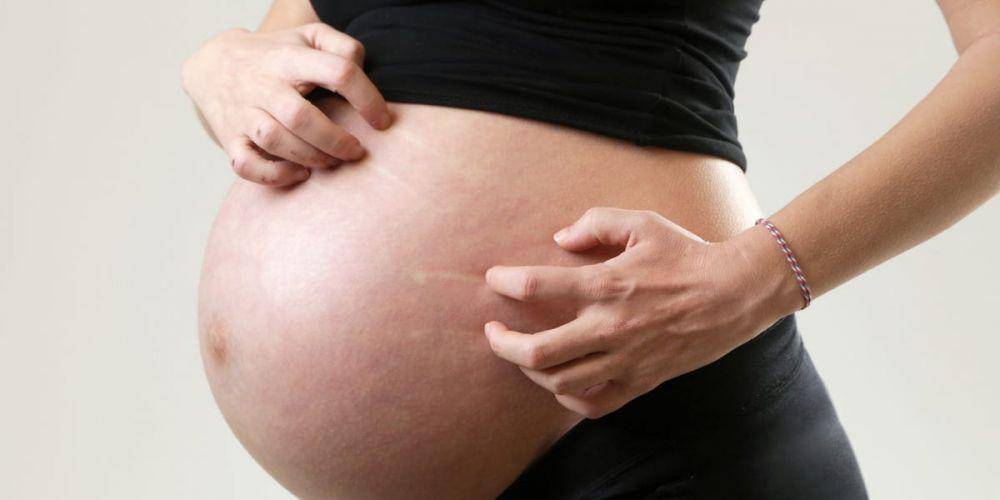 ilustrasi gatal-gatal saat hamil karena kolestasis obstetri (insider.com)