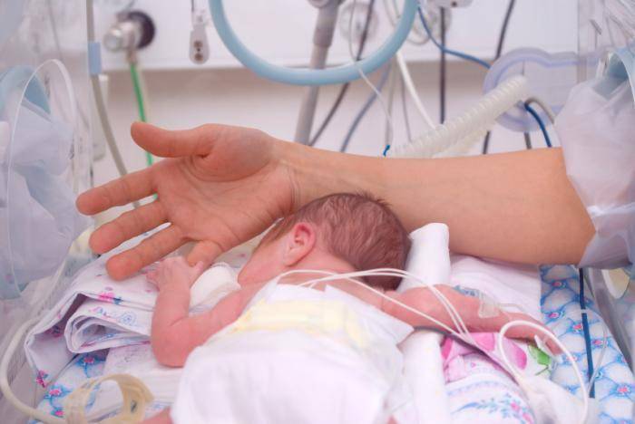 ilustrasi bayi lahir prematur (medicalnewstoday.com)