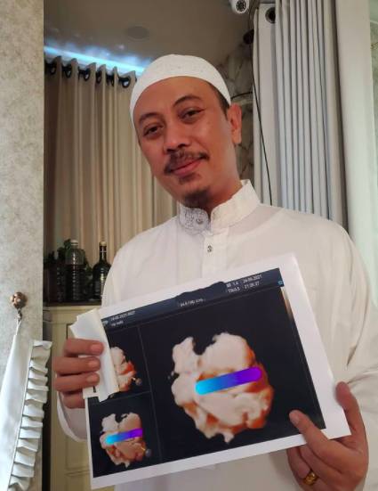 Persalinan Bebi Silvana Istri Opick (instagram.com/bebi.silvana)
