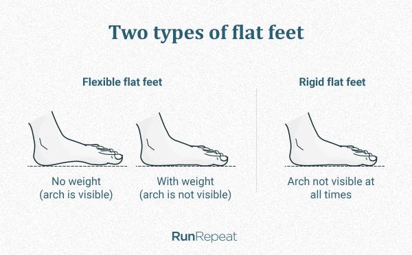 ilustrasi jenis kaki datar (runrepeat.com)