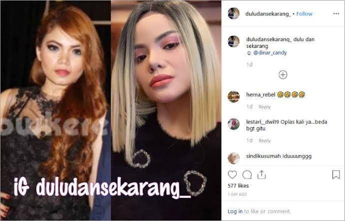 dinar (instagram.com/duludansekarang_)