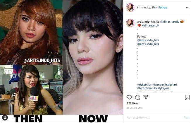 Transformasi dinar (instagram.com/artis.indo_hits)
