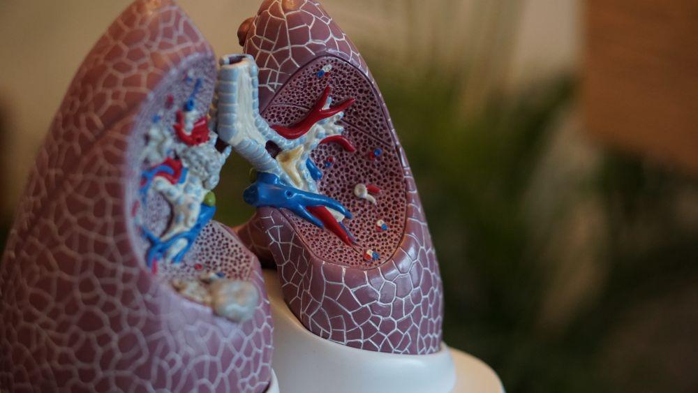 Asbestosis: Gejala, Penyebab, Pengobatan, dan Pencegahan