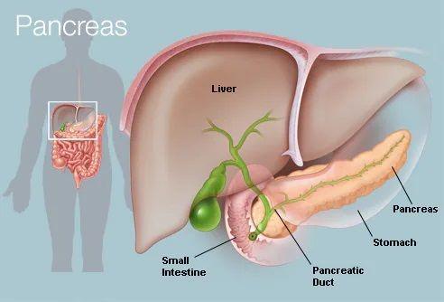 Inovasi Pankreas Buatan Pertama, Bantu Obati Diabetes