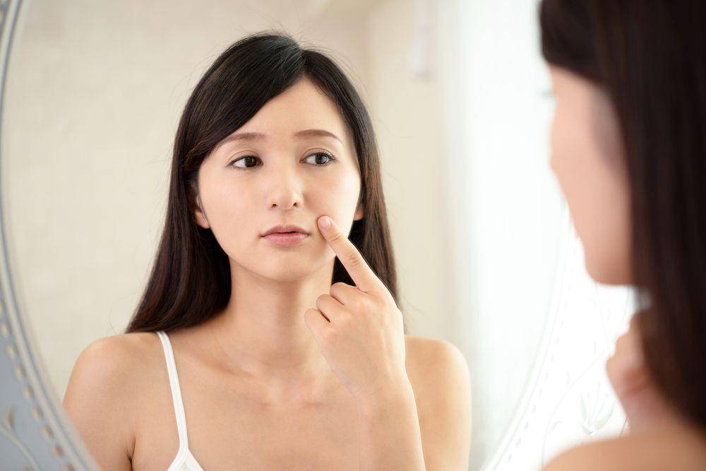 Seorang wanita yang keluhkan kondisi wajah (Shutterstock/Liza888)