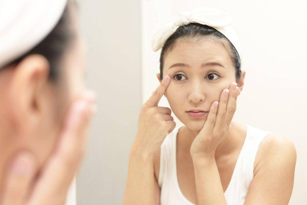 Seorang wanita yang keluhkan kerutan pada wajah (Shutterstock/Liza888)