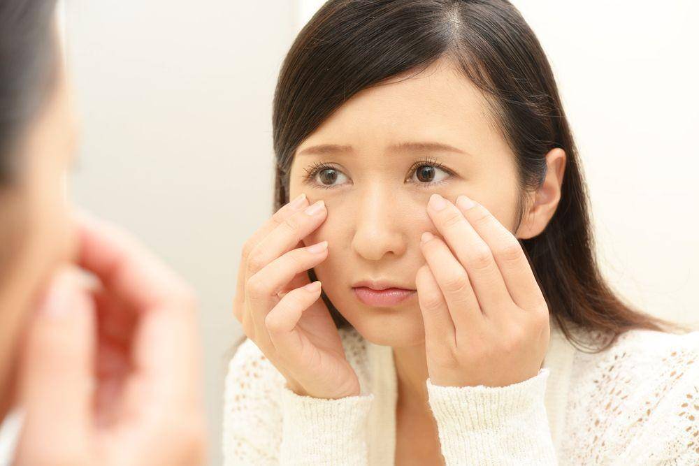 Seorang wanita keluhkan kondisi wajah yang kusam (Shutterstock/Liza888)