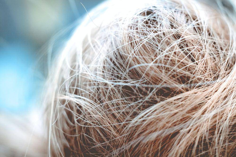 ilustrasi rambut kering (unsplash.com/Niklas Hamann)
