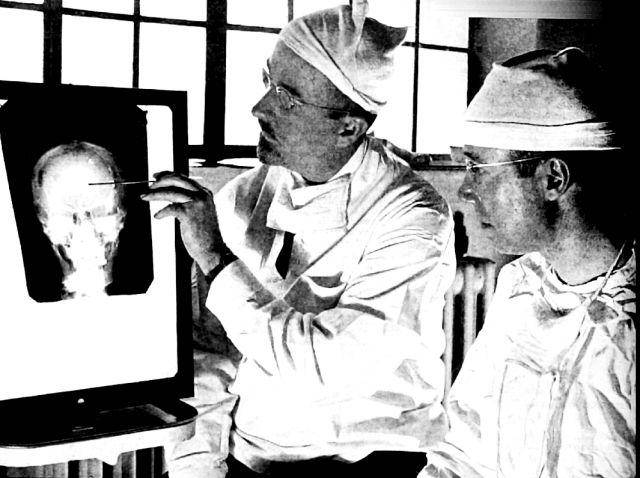Dr. Walter Freeman dan rekannya melihat foto X-Ray pasien sebelum operasi tahun 1941. (washingtonian.com)