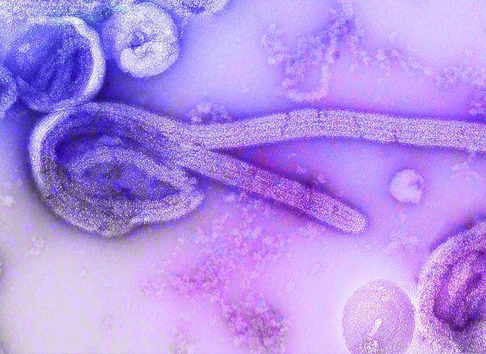 virus Ebola pada tahun 1976 dengan menggunakan mikroskop (unsplash.com/CDC)