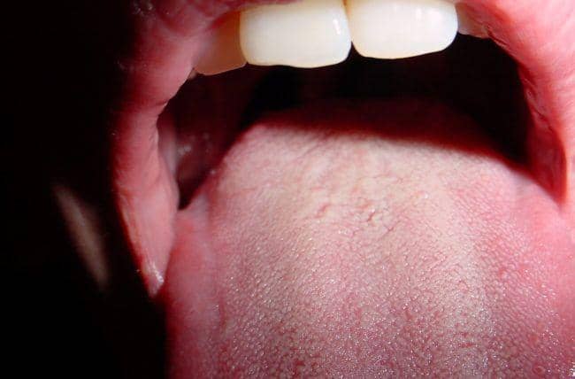 ilustrasi indra perasa lidah (health.clevelandclinic.org)