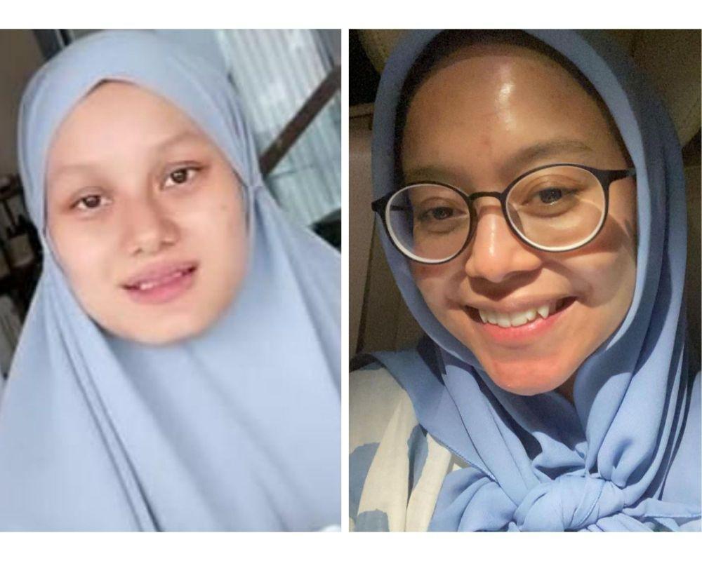 10 Adu Pesona Lesti Kejora Vs Dinda Hauw Tanpa Makeup, Natural Sekali