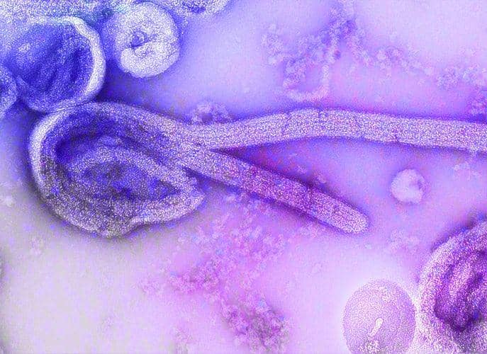 ilustrasi virus Ebola dengan menggunakan mikroskop (unsplash.com/CDC)