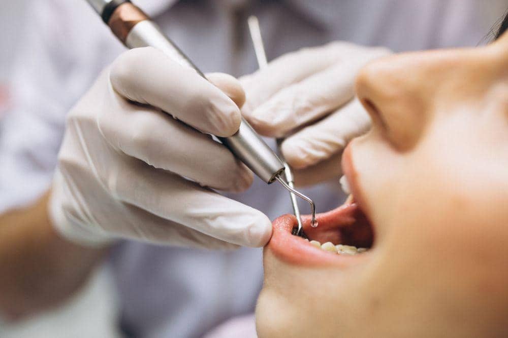Viral di TikTok, Dokter Gigi Bisa Tahu Seseorang Sering Seks Oral