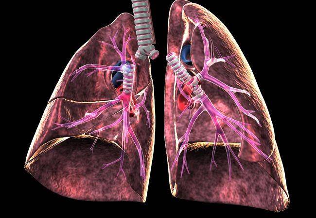 ilustrasi paru-paru (consultqd.clevelandclinic.org)