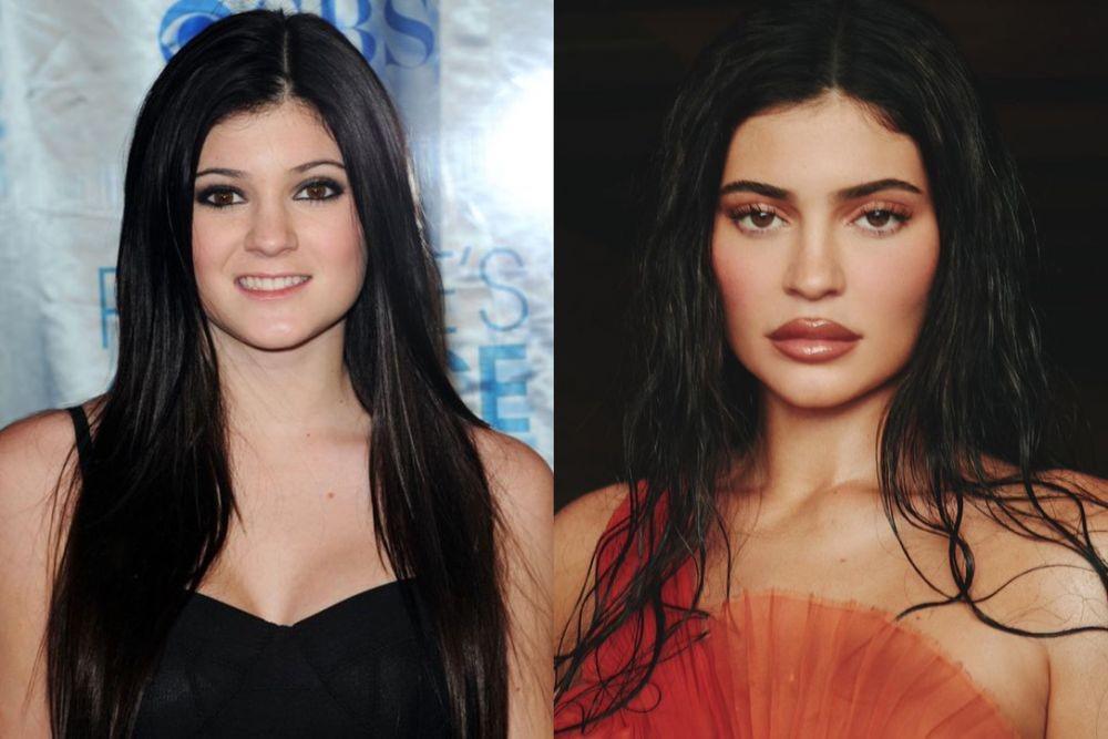 Hamil Lagi, 10 Potret Kylie Jenner Dulu Vs Kini yang Beda Banget!