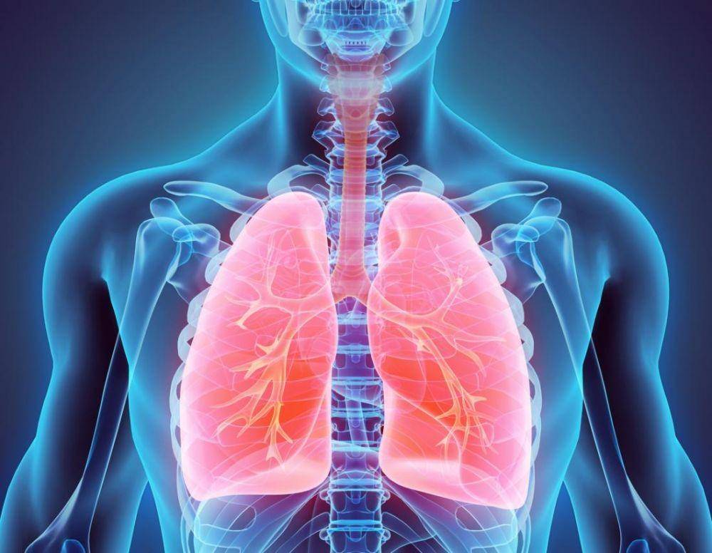 ilustrasi paru-paru yang mengalami ARDS (medicalnewstoday.com)
