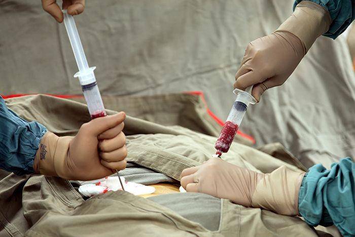 transplantasi sumsum tulang belakang (isthealth.com.tr)